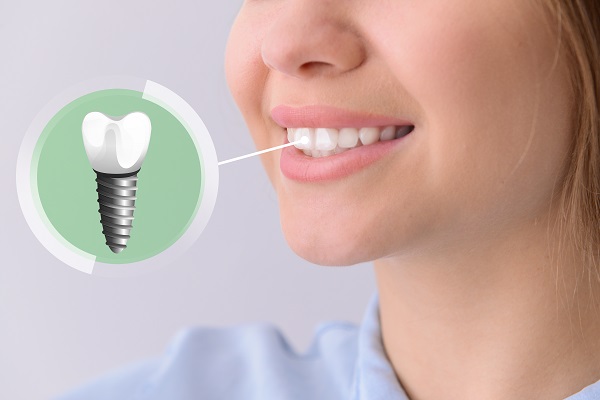 Colina Dental